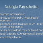 Notalgia Paresthetica