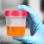 What is Orange Colored Urine? Why is My Urine Orange