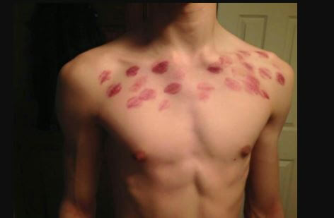 Hickies take out how to Hickeys, Wow